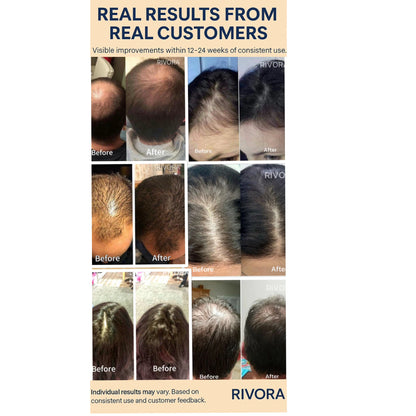 Rivora Red Light Therapy Cap