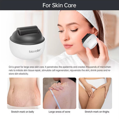 Bio G4 Derma Roller Microneedle 1200Pin Needles for Beard Hair Growth Dermaroller anti Acne Scars Removal Wrinkle Shrink Pores